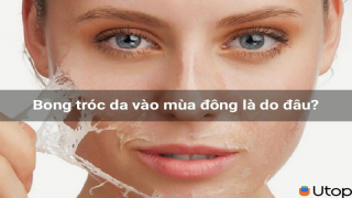 Bong tróc da vào mùa đông là do đâu? Mẹo giúp làn da luôn ẩm mịn khi trời lạnh