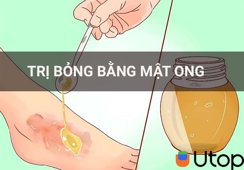 Giúp trị được bỏng, kháng khuẩn, khử trùng hiệu quả