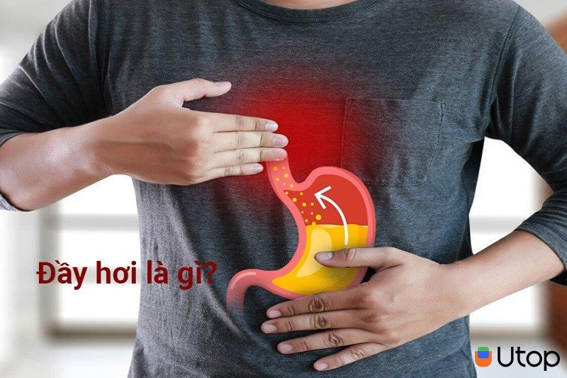 Đầy hơi là gì?