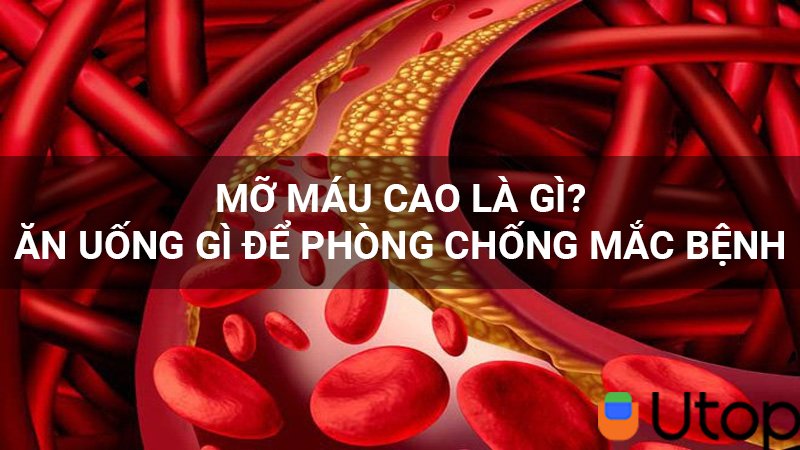 Mỡ máu cao là bệnh gì? Ăn uống gì để phòng tránh mắc bệnh