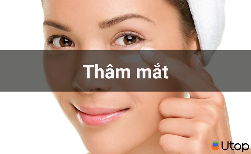 Những mẹo trị thâm mắt chỉ sau 2 tuần bạn nên biết