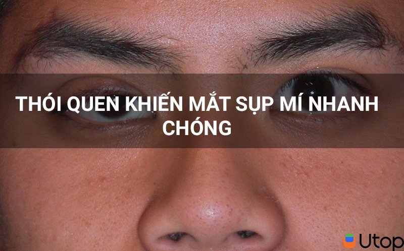 Tránh xa những thói quen khiến mắt bạn sụp mí nhanh hơn