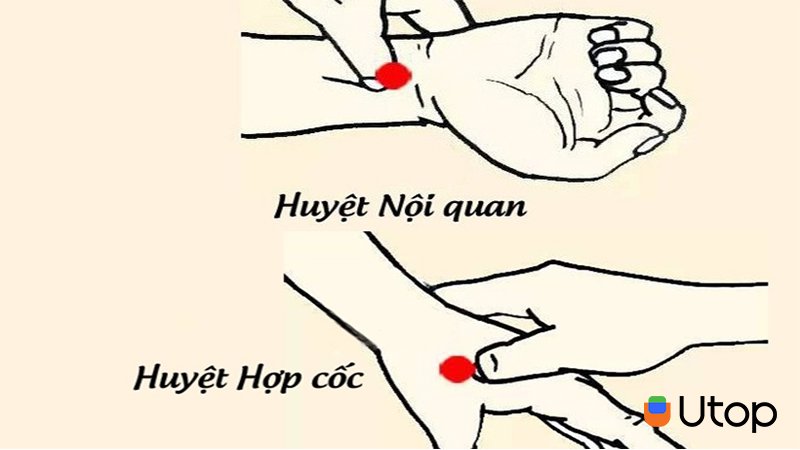 Châm cứu và bấm huyệt