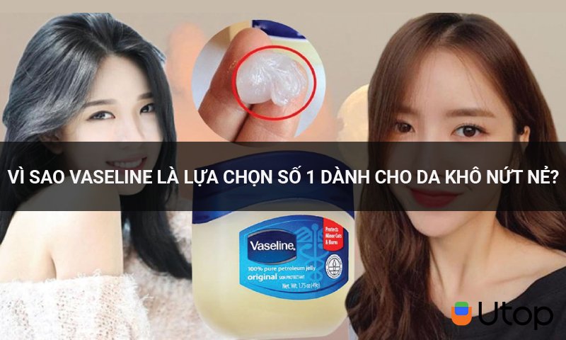 Vì sao vaseline là lựa chọn số 1 dành cho da khô nứt nẻ?