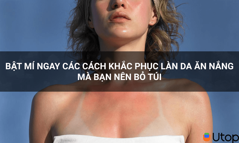 Bật mí ngay các cách khắc phục làn da ăn nắng mà bạn nên bỏ túi!