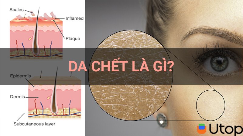 1. Da chết là gì? Vì sao cần tẩy da chết?