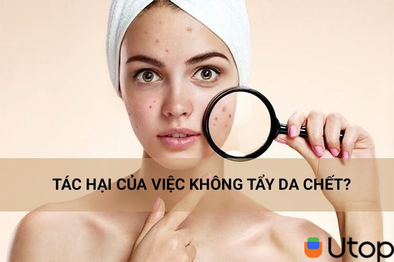 3. Tác hại của việc không tẩy da chết