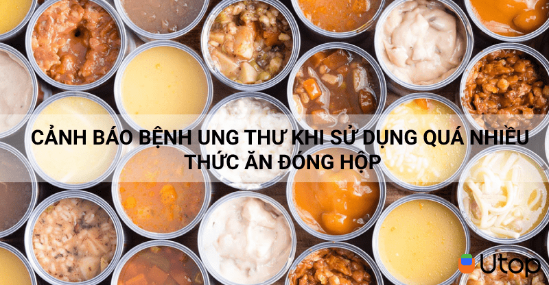 Cảnh báo bệnh ung thư khi sử dụng quá nhiều thức ăn đóng hộp