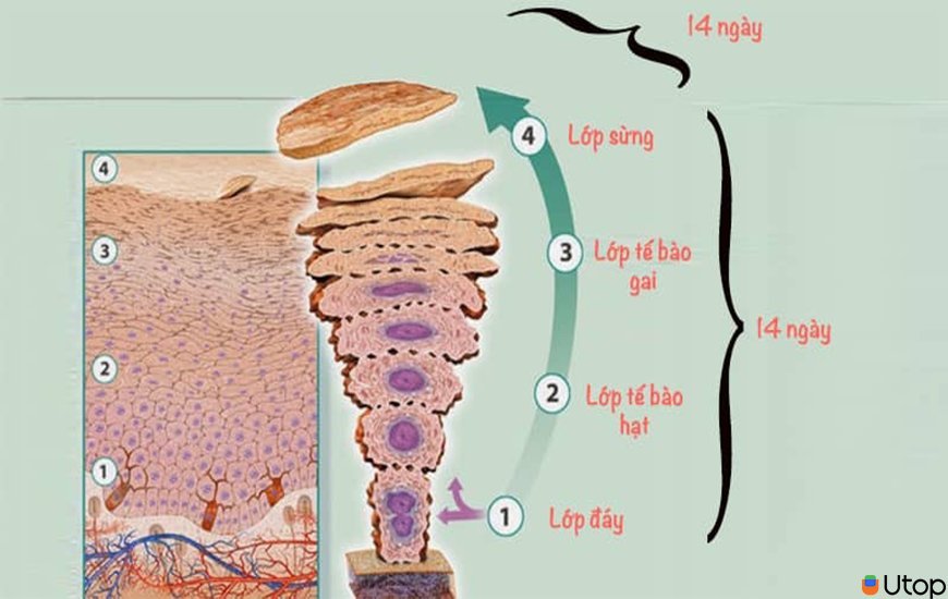 Xử lý mụn đầu đen đúng cách ngay tại nhà