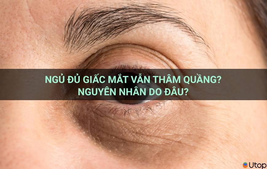 Ngủ đủ giấc mắt vẫn thâm quầng? Nguyên nhân do đâu?