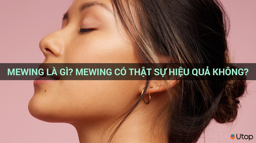 Mewing là gì? Mewing có thật sự hiệu quả không?