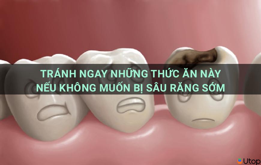 Tránh ngay những thức ăn này nếu không muốn bị sâu răng sớm