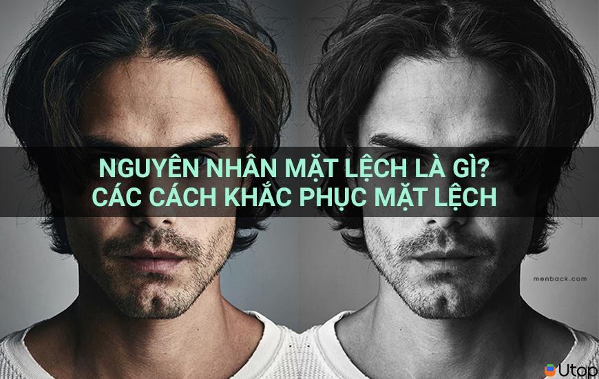 Nguyên nhân mặt lệch là gì? Các cách khắc phục mặt lệch 