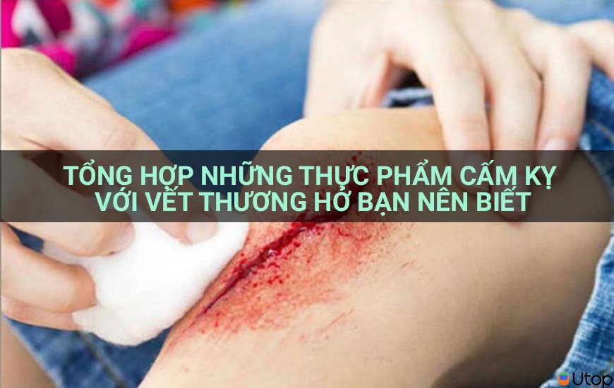 Tổng hợp những thực phẩm cấm kỵ với vết thương hở bạn nên biết