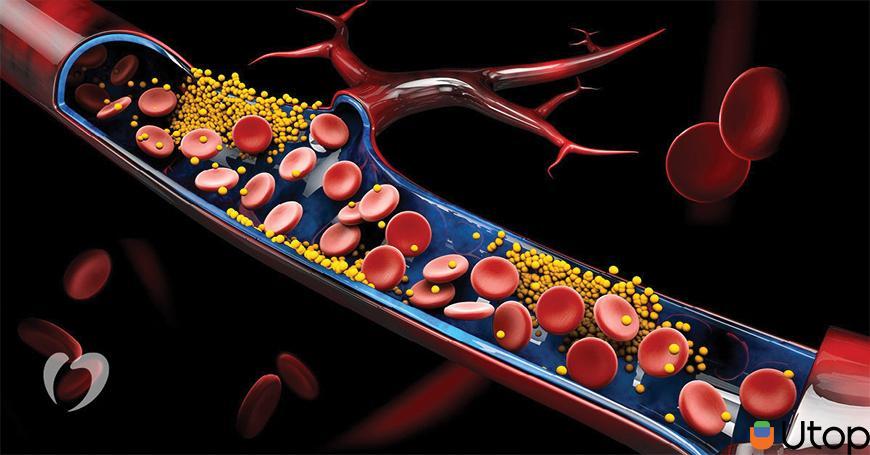 Chất béo liên hệ gì với hàm lượng cholesterol