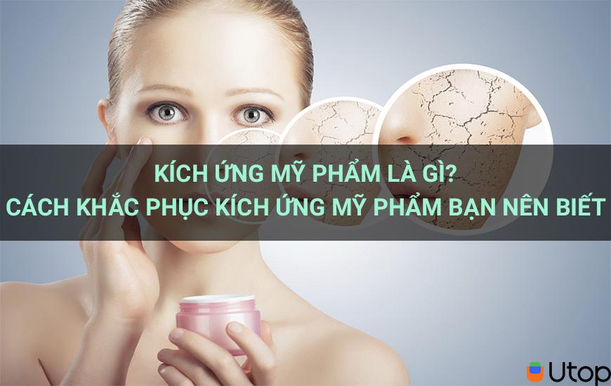 Kích ứng mỹ phẩm là gì? Cách khắc phục kích ứng mỹ phẩm bạn nên biết