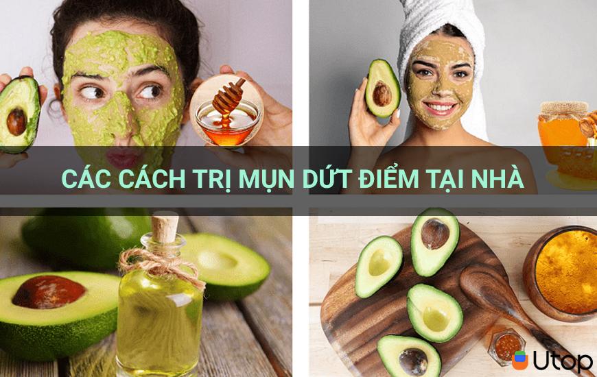 Cách trị mụn dứt điểm tại nhà bằng nguyên liệu lành tính