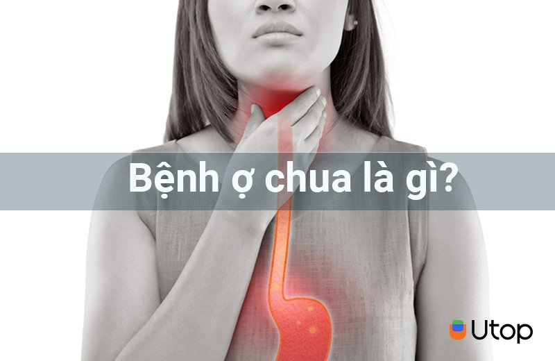 Ợ chua là gì?