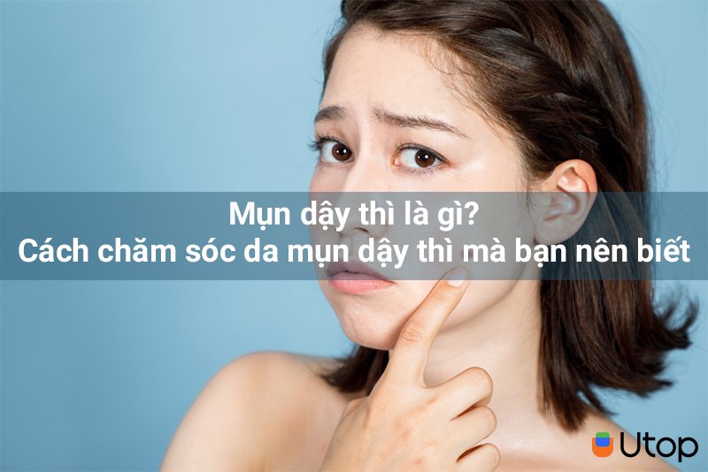 Mụn dậy thì là gì? Cách chăm sóc da mụn dậy thì mà bạn nên biết