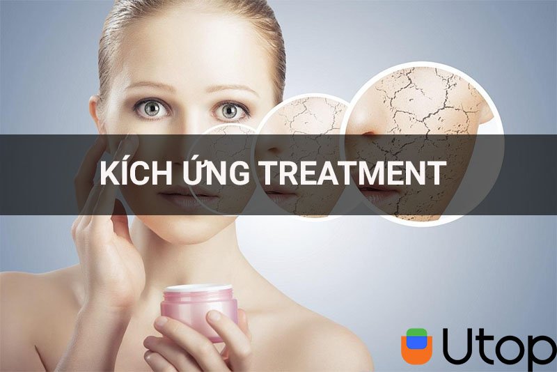 Phải làm gì khi da bị kích ứng với các sản phẩm treatment? Cách khắc phục