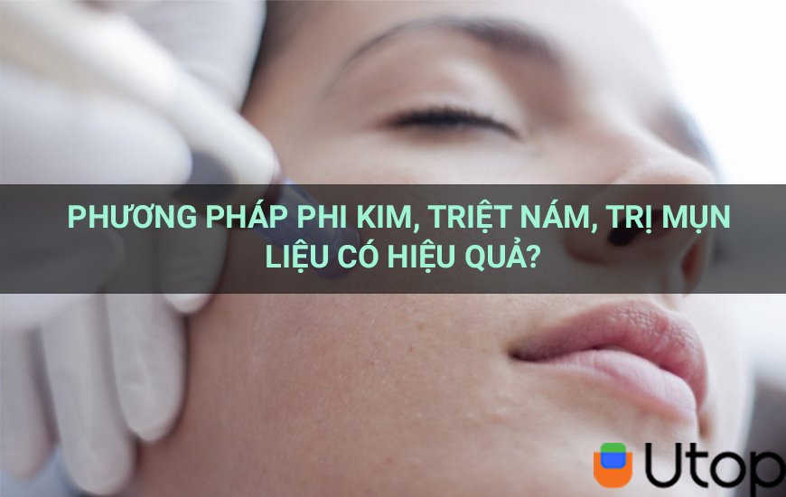 Phương pháp phi kim, triệt nám, trị mụn liệu có hiệu quả?