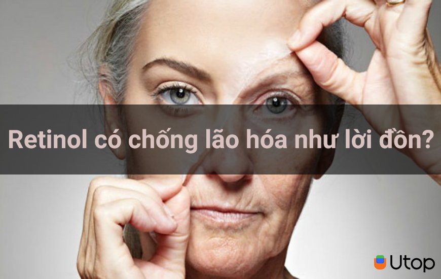 Retinol có chống lão hóa như lời đồn?