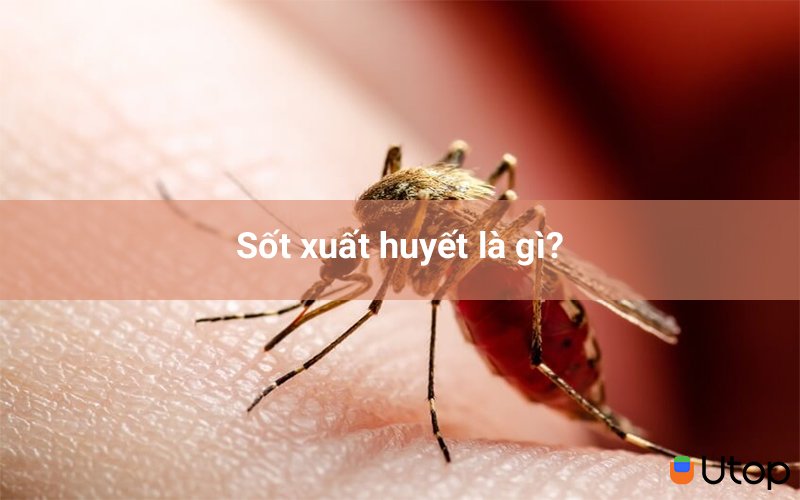 Sốt xuất huyết là gì? Sốt xuất huyết nguy hiểm như thế nào tới tính mạng?