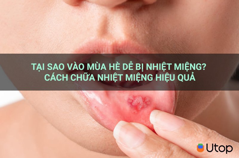 Tại sao vào mùa hè dễ bị nhiệt miệng? Cách chữa nhiệt miệng hiệu quả