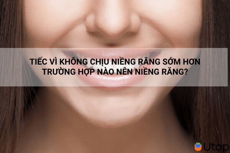 Tiếc vì không chịu niềng răng sớm hơn. Trường hợp nào nên niềng răng?