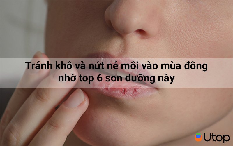 Tránh khô và nứt nẻ môi vào mùa đông nhờ top 6 son dưỡng này