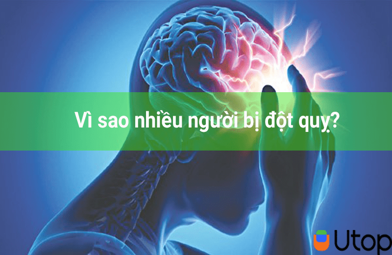 Vì sao nhiều người bị đột quỵ? Cách phòng tránh đột quỵ để bảo vệ sức khỏe