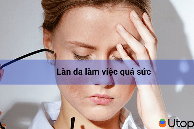 Làn da làm việc quá sức