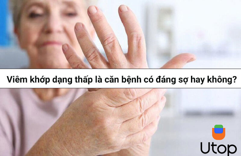 Viêm khớp dạng thấp là căn bệnh có đáng sợ hay không?