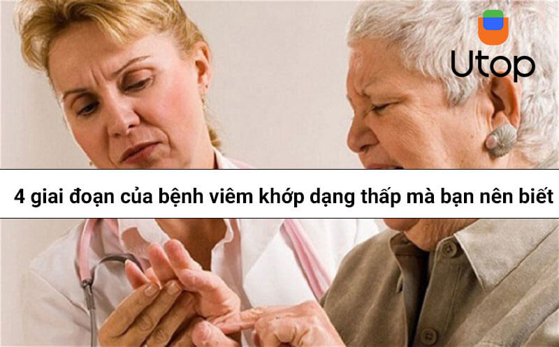 4 giai đoạn của bệnh viêm khớp dạng thấp mà bạn nên biết