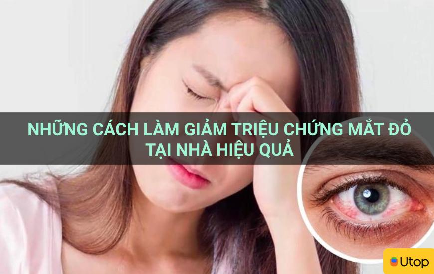 Những cách làm giảm triệu chứng mắt đỏ tại nhà hiệu quả