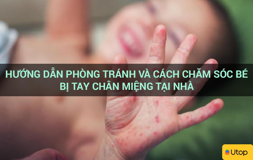 Hướng dẫn phòng tránh và cách chăm sóc bé bị tay chân miệng tại nhà