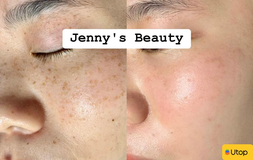  Mã giảm giá Utop khi mua voucher Jenny’s Beauty